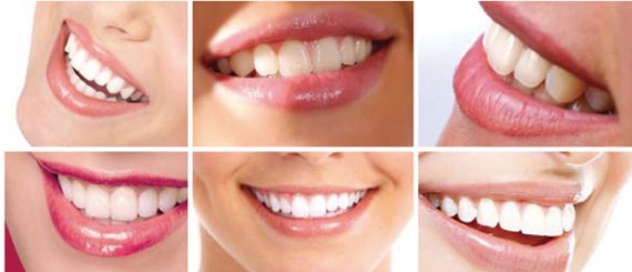 白く健康的な歯で、笑顔をより印／象的に＠「スターライトデンタル」